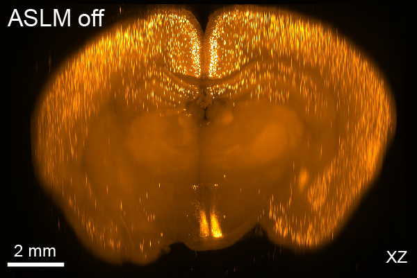Typical XZ view of a whole mouse brain.