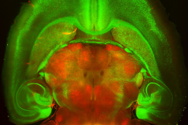 Rbp4Cre-YCX2.60 mouse brain cleared using passive CLARITY: L5 neurons and autofluorescence