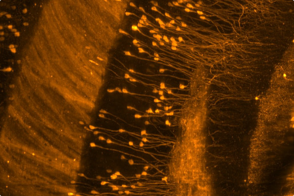 Rbp4Cre-YCX2.60 mouse brain cleared using passive CLARITY: Hippocampus (XZ view)