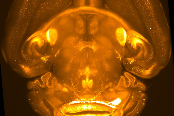 Overview image of a TPH2Cre-tdTomato mouse brain cleared using passive CLARITY.