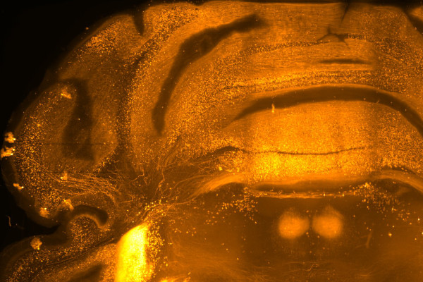 Overview image (XZ view) of a TPH2Cre-tdTomato mouse cerebellum cleared using passive CLARITY.