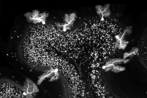 Purkinje neurons in the cerebellum of a TPH2Cre-tdTomato mouse brain cleared using passive CLARITY.